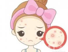 哪些因素影响祛痘手术的价格?