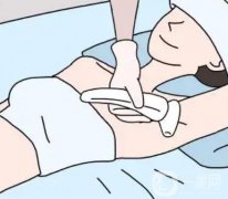 超冰脱毛的价格受哪些因素影响?