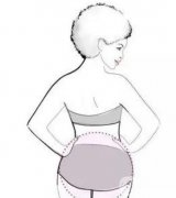 哪些因素影响腰部吸脂的价格？