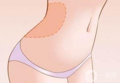 全身吸脂手术不适合哪些人？