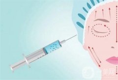 什么因素影响玻尿酸填充泪沟的价格？