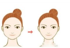 整容的风险有哪些？