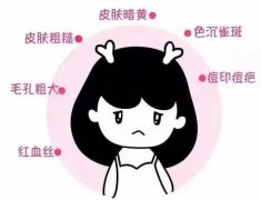 做光子嫩肤恢复需要多久？