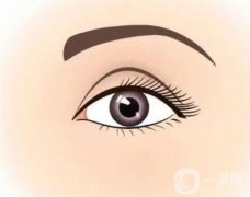 割双眼皮的缺点有哪些？