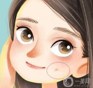 人造酒窝有哪些禁忌症？