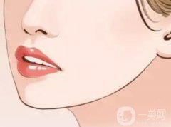 隆下颌术的注意事项有哪些？