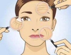 什么是间断悬吊除皱术,果怎么样？