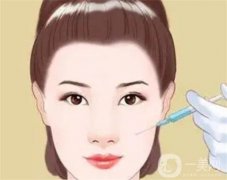 脸部凹陷填充玻尿酸能保持多久？