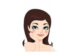 全身嫩肤果好吗?多少钱一次?