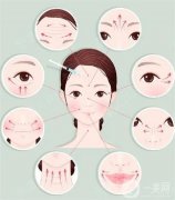 面部激光除皱一次多少钱？