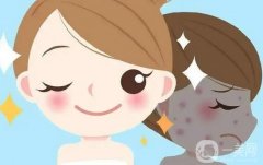 光子嫩肤的性怎么样？