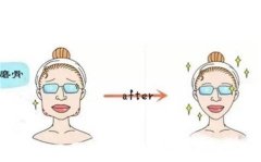 面部整形有哪项目？