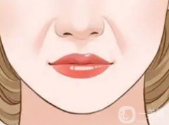 脂肪填充法令纹的价格是多少？