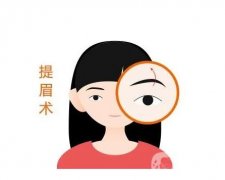 微创提眉术手术方法？微创提眉术的特点？