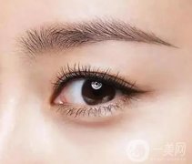 外眦成形术有哪些方法?