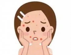 果酸去痘坑好还是激光去痘坑果好?两种方式有什么区别吗?那种技术比较好?