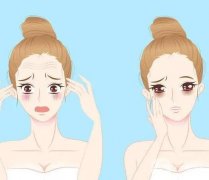 除皱有哪些类型？除皱手术的注意事项？