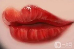 唇弓成形术有哪些方法