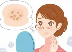 专业彩光嫩肤祛斑的原理是什么?价格大概是多少?