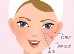 胶原蛋白填充泪沟果好不好？填充前后需要注意什么