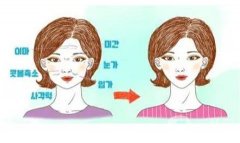 热玛吉对法令纹有没有用？热玛吉的应用果？