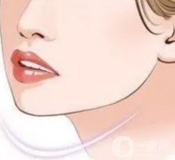 下颌角切骨后需要戴头套多长时间？