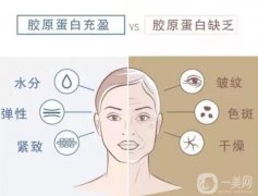 胶原蛋白注射后果能持续多久？胶原蛋白和玻尿酸的区别？