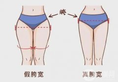 假胯宽可以减掉吗？具体都有哪些方法呢？