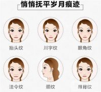 电波拉皮是什么？作用与价格？