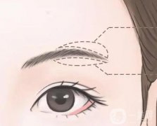 切眉有什么作用和副作用？