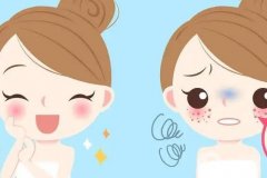 祛痣有什么风险吗？哪种祛痣方法好？