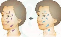 脂肪填充后多久可以使用护肤品、洗面奶、化妆品？