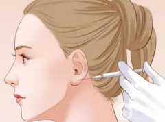 影响玻尿酸丰耳垂价格的因素？果如何呢？