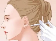 玻尿酸丰耳垂会不会栓塞？如何降低玻尿酸丰耳垂的风险？