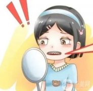 牙齿贴面的缺点及注意事项？