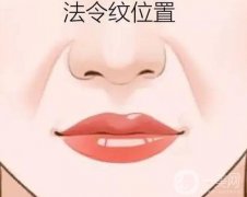 用脂肪填充法令纹能管多久？果如何？