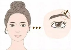 导致眉弓填充不均匀的原因？