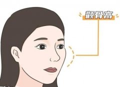 降低颧弓和颧骨内推有什么不同？