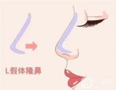 假体隆鼻可以修复吗？有什么注意事项