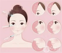 脂肪填充大的肿胀是哪一天？