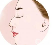 驼峰鼻矫正多久能恢复？需要注意什么？