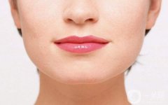 做激光酒糟鼻调节的流程是什么?恢复时间要多久?