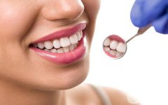 做牙齿稀疏禁忌人群及适宜人群有哪些?