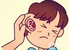 生物支架再造耳有哪些优势