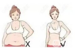 水动力吸脂会反弹吗？如何避免反弹？