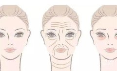 电波拉皮的作用和副作用？一个疗程要做几次？