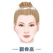 颧骨垫高消肿需要多长时间？颧骨垫高疼吗