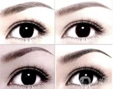 激光洗眉会出血吗？洗眉毛不出血的激光仪有哪些？