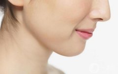 做肋软骨垫鼻尖禁忌人群及适宜人群有哪些?