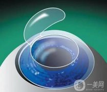 眼部做激光手术有哪些危害？术后怎么护理？